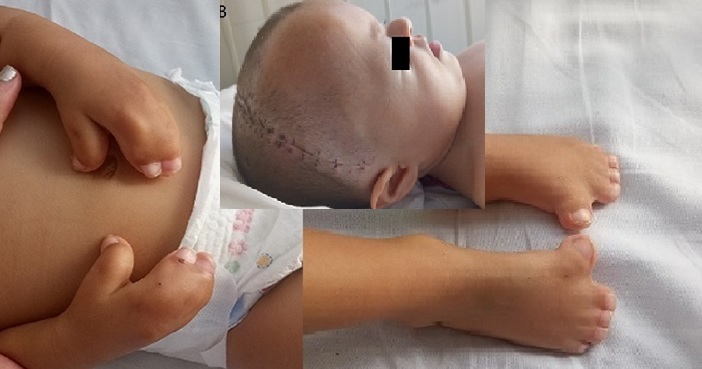 Foto descriptiva de las alteraciones anatómicas del paciente